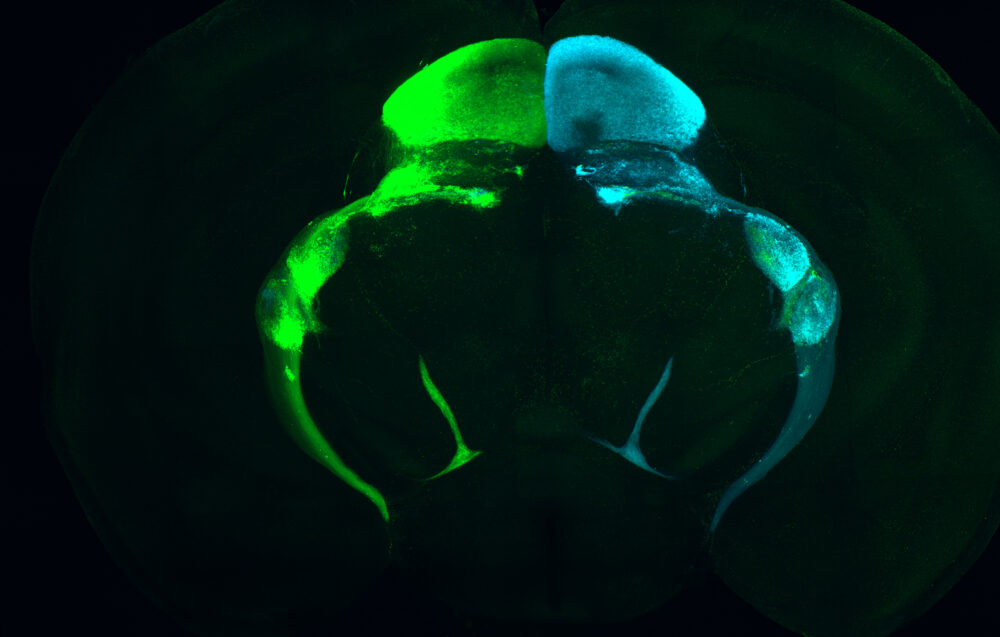Contra- and ipsilateral retinal ganglion cell projections to ...